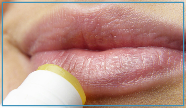 How to Get Rid of Dry and Chapped Lips Effective Tips for Smooth, Healthy Lips