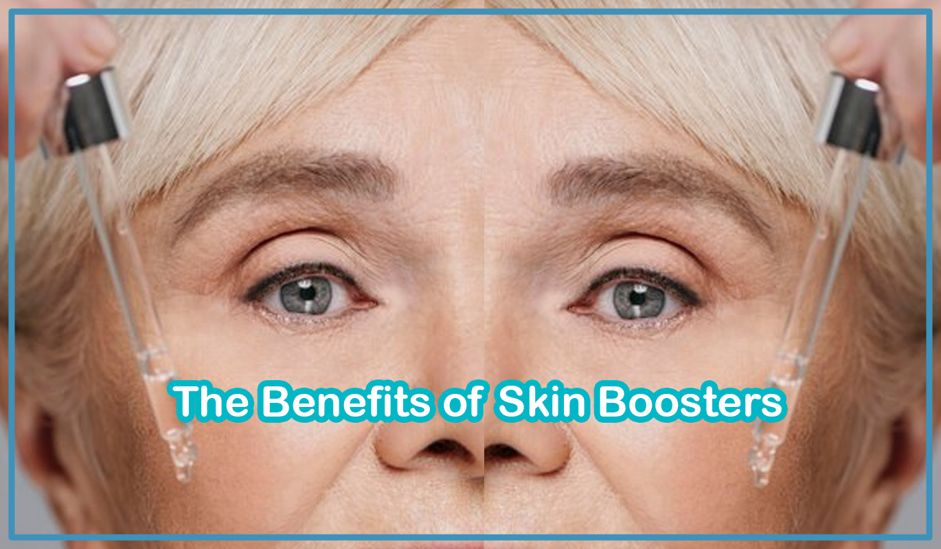 The Benefits of Skin Boosters